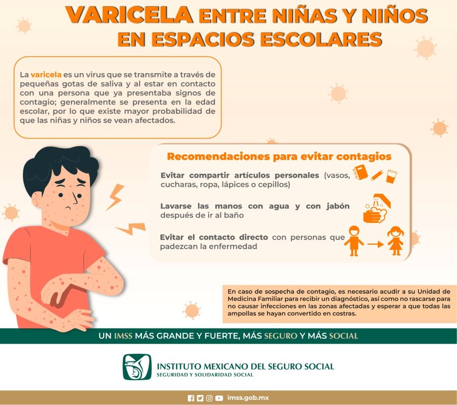 Emite IMSS Hidalgo Recomendaciones Para Evitar Contagios de Varicela en Este Regreso a Clases